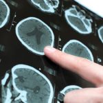 Neurolog dziecięcy